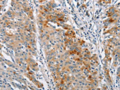 BCL10 Antibody