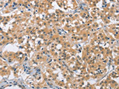 BCL10 Antibody