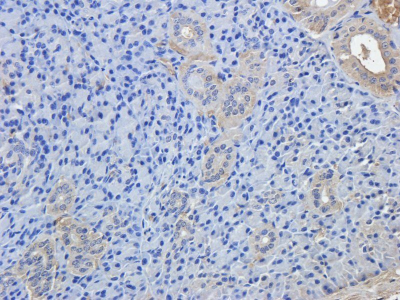 BCL2 antibody