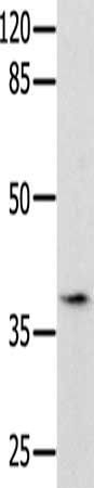 BDNF Antibody