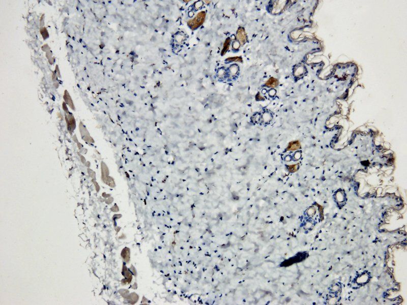 BDNF antibody