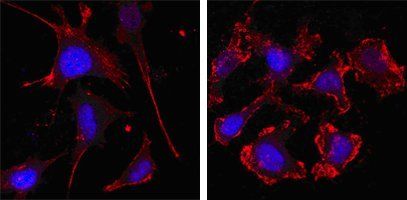 beta-Actin
