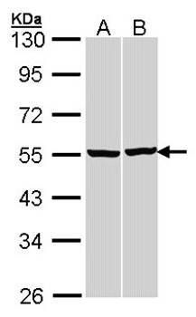 beta Tubulin antibody