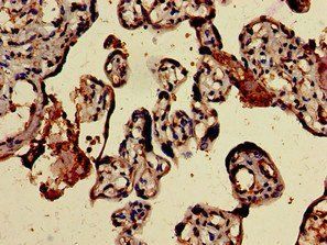 BMPR1B Antibody