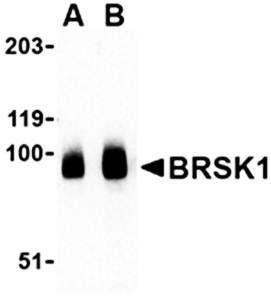 BRSK1 Antibody