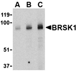 BRSK1 Antibody