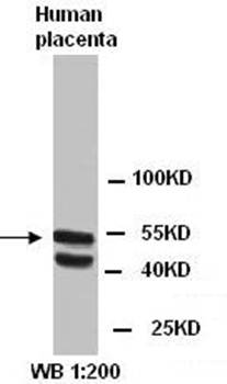 EAAC1 Rabbit Polyclonal Antibody