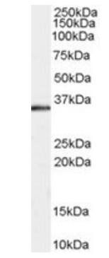 STUB1/CHIP Antibody