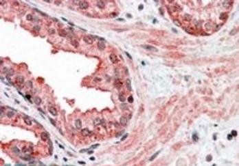 GCIP/MAID Antibody