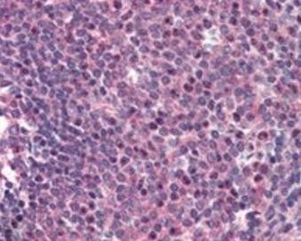 CARD11 Antibody