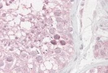 RNF36/TRIM69 Antibody