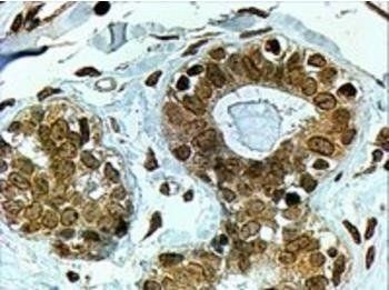 CYP7B1 Antibody