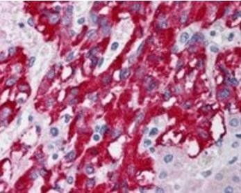 DLC1 (Isoforms 1 and 3) Antibody