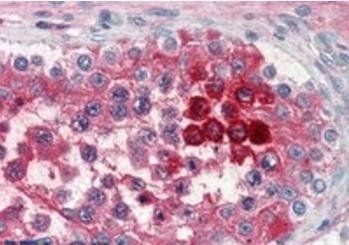 Clusterin/APOJ Antibody