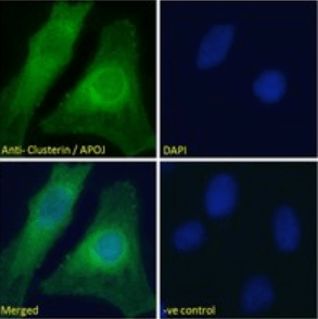 Clusterin/APOJ Antibody