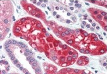 Ezrin/villin 2 Antibody