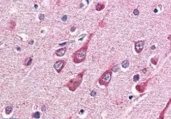 OGT Antibody