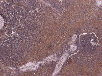 P4HA1 Antibody