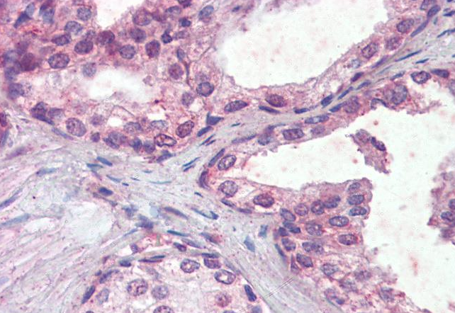 Goat anti-IFNAR2 Antibody