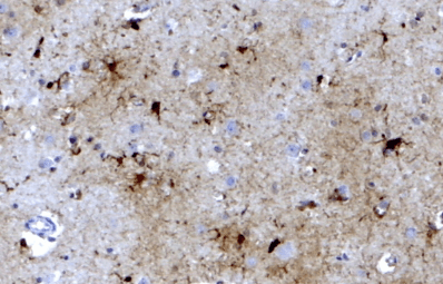 FTL Antibody