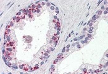 Annexin I Antibody