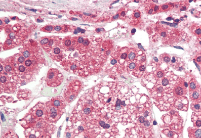 TGFBR1 (aa50-63) Antibody