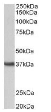 Goat anti-Clusterin / ApoJ (mouse, aa312-325) Antibody