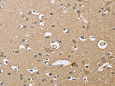 ECHS1 Antibody