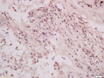 Phospho-EGFR (Tyr1092) Rabbit Polyclonal Antibody