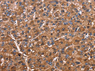 ELP2 Antibody