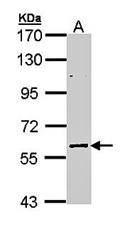 ELP3 antibody