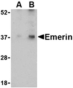 Emerin Antibody