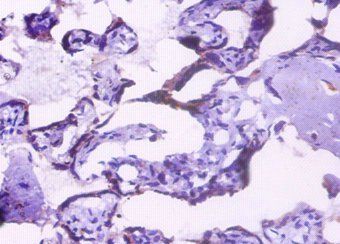 HSP90B1 Antibody
