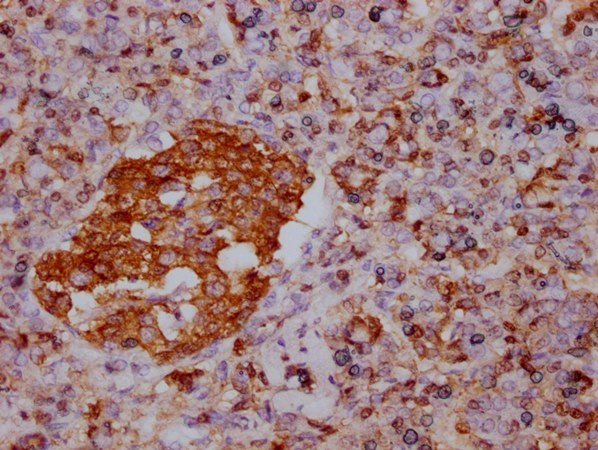 ENO1 Monoclonal Antibody