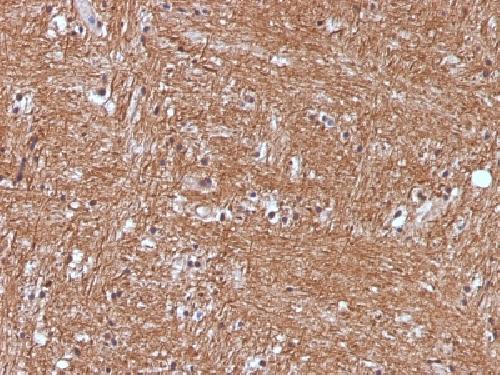 NSE gamma (Neuron Specific Enolase, gamma) (Neuroendocrine Marker) Antibody