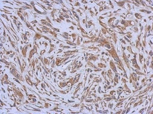 ENTPD3 antibody [N3C3]