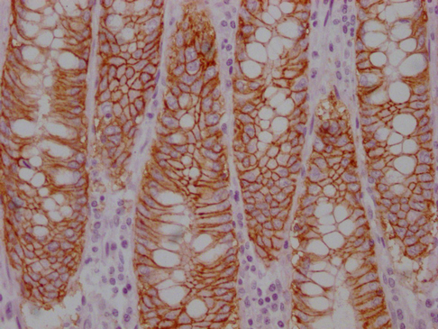 EPCAM Monoclonal Antibody