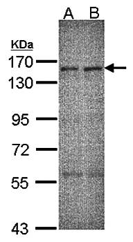 ERCC6 antibody