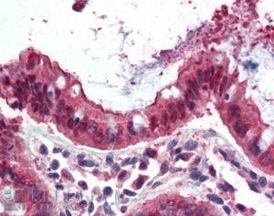 Ezrin/villin 2 Antibody