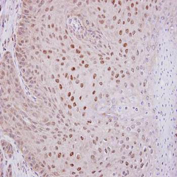 O-GlcNAc transferase antibody