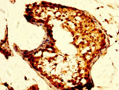 OPRM1 Antibody