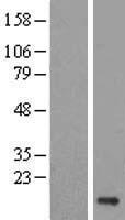 UBE2V1 Human Over-expression Lysate