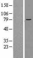 ALOX12B Human Over-expression Lysate