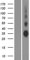 Aquaporin 7 (AQP7) Human Over-expression Lysate
