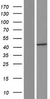Caspase 1 (CASP1) Human Over-expression Lysate