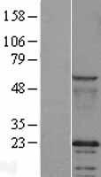 Caveolin 2 (CAV2) Human Over-expression Lysate
