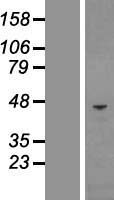 CHI3L1 Human Over-expression Lysate