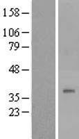 DPAGT1 Human Over-expression Lysate