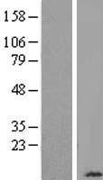 Cytochrome C Oxidase subunit VIb (COX6B1) Human Over-expression Lysate