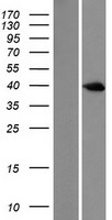 DUSP6 Human Over-expression Lysate